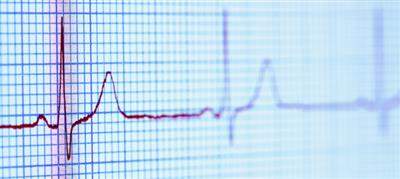 New guidelines aim to prevent sudden cardiac death