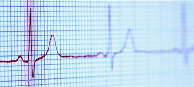 sudden cardiac prevent aim guidelines death safebeat