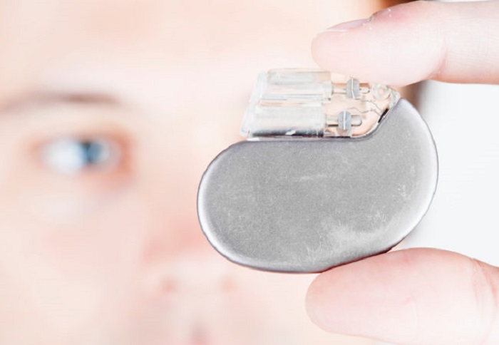 More Than Fancy Pacemakers: How ICDs Help You