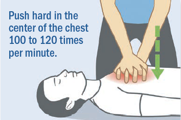 The importance of bystander CPR