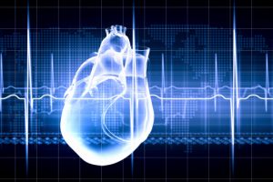 Ventricular arrhythmia